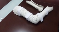 宜春南昌矫形器-步行矫型器在脊髓损伤中的作用